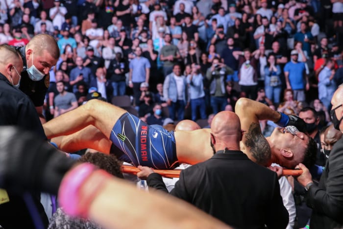 Chris Weidman after his leg injury.