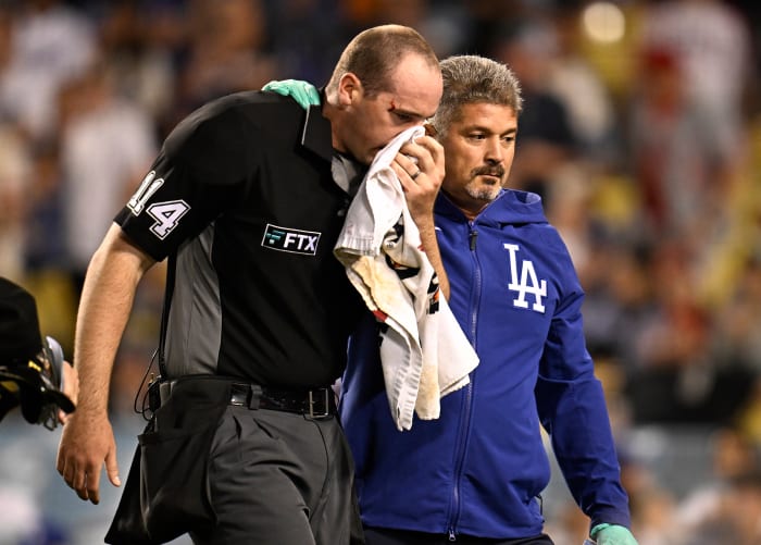Los Angeles, CA - June 14: Home plate umpire Nate Tomlinson is treated by Los Angeles Dodgers trainer Nathan Lucero after being hit in the face off a broken bat by Mike Trout (not pictured) of the Los Angeles Angels against the Los Angeles Dodgers in the ninth inning of a MLB baseball game at Dodger Stadium in Los Angeles on Tuesday, June 14, 2022. (Photo by Keith Birmingham/MediaNews Group/Pasadena Star-News via Getty Images)