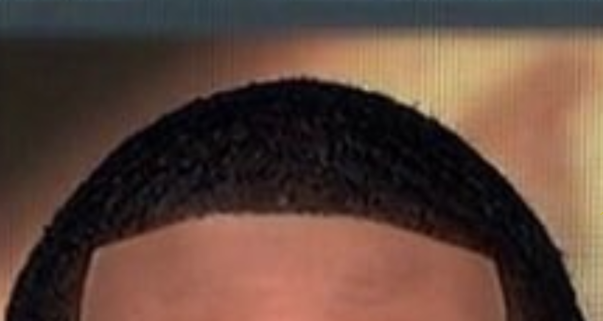 What Is Up With Jalen Rose's Hair? - Hair System