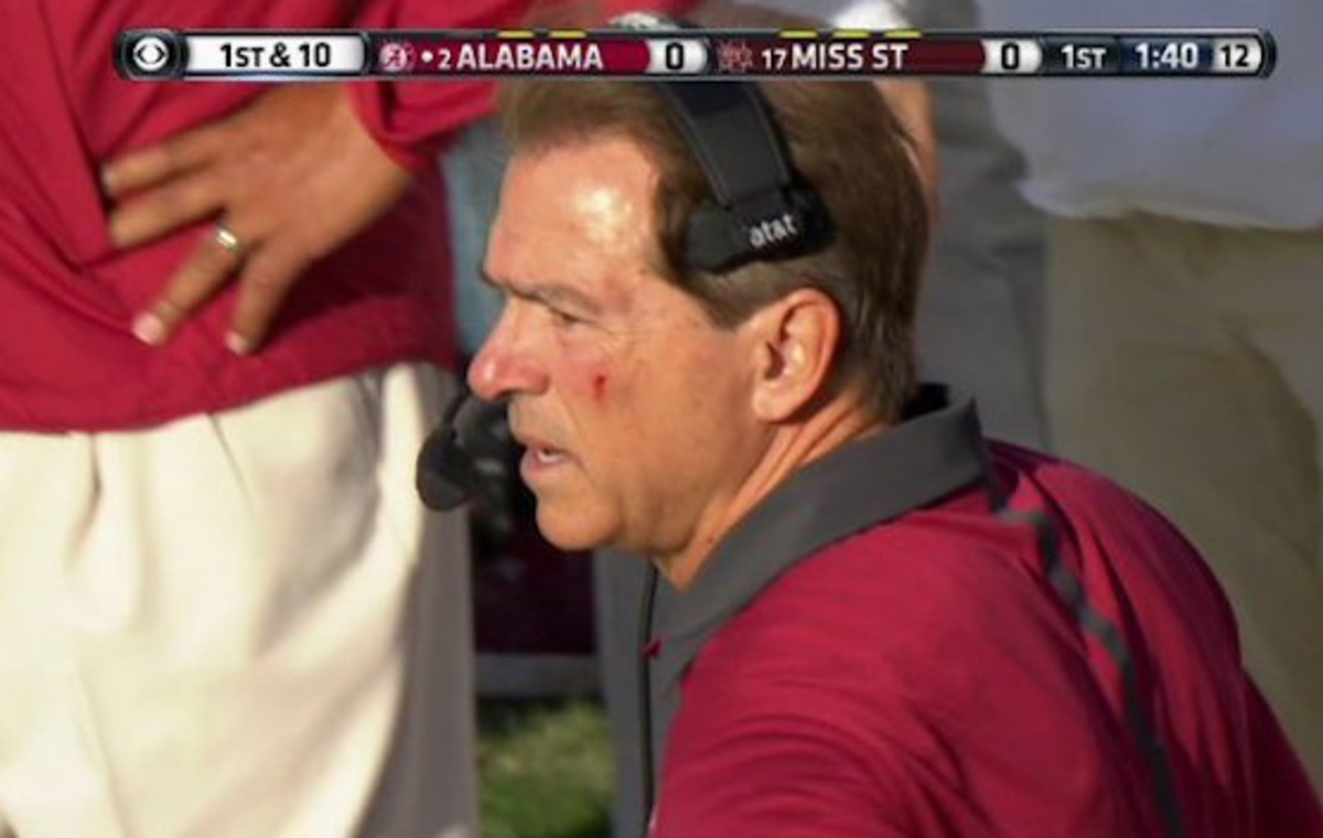Nick Saban seen with a cut on his face on the Alabama sideline.