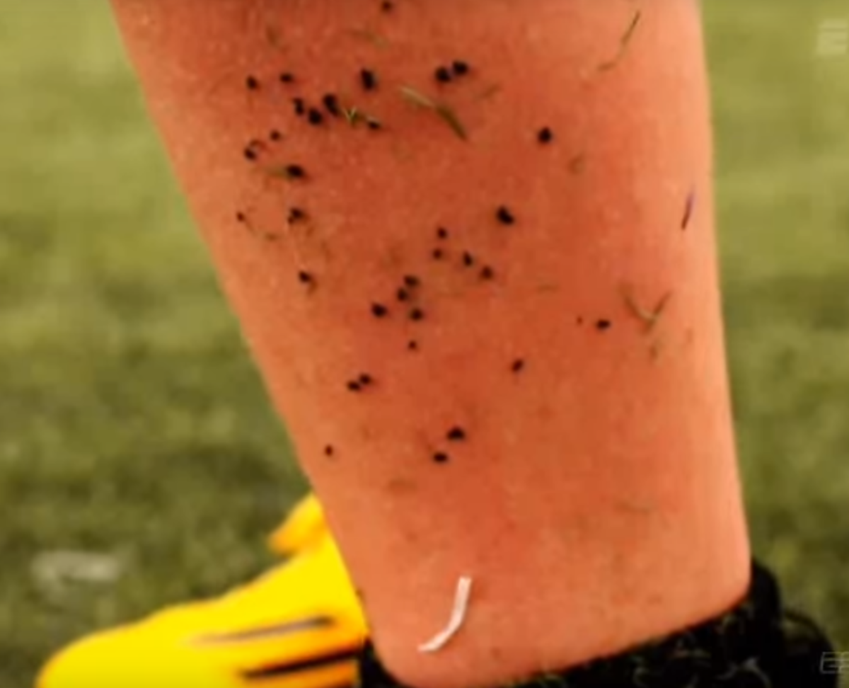 A close up of turf on someones leg.