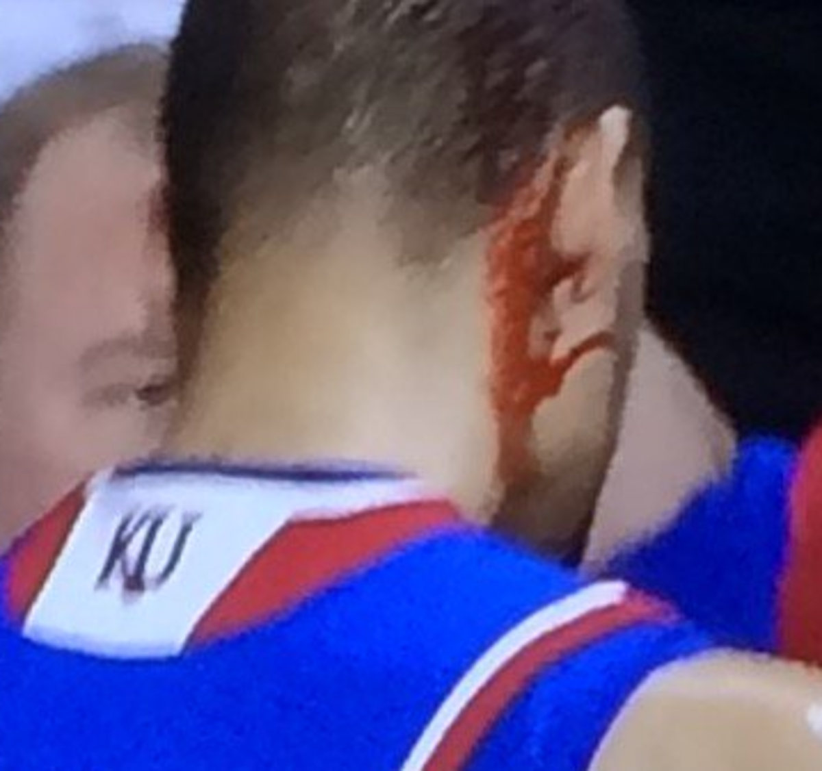 Perry Ellis bloodied up during game against Kansas State.