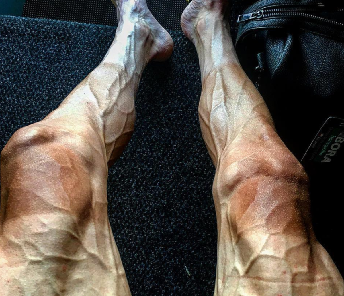 A graphic shot of a cyclist's legs.