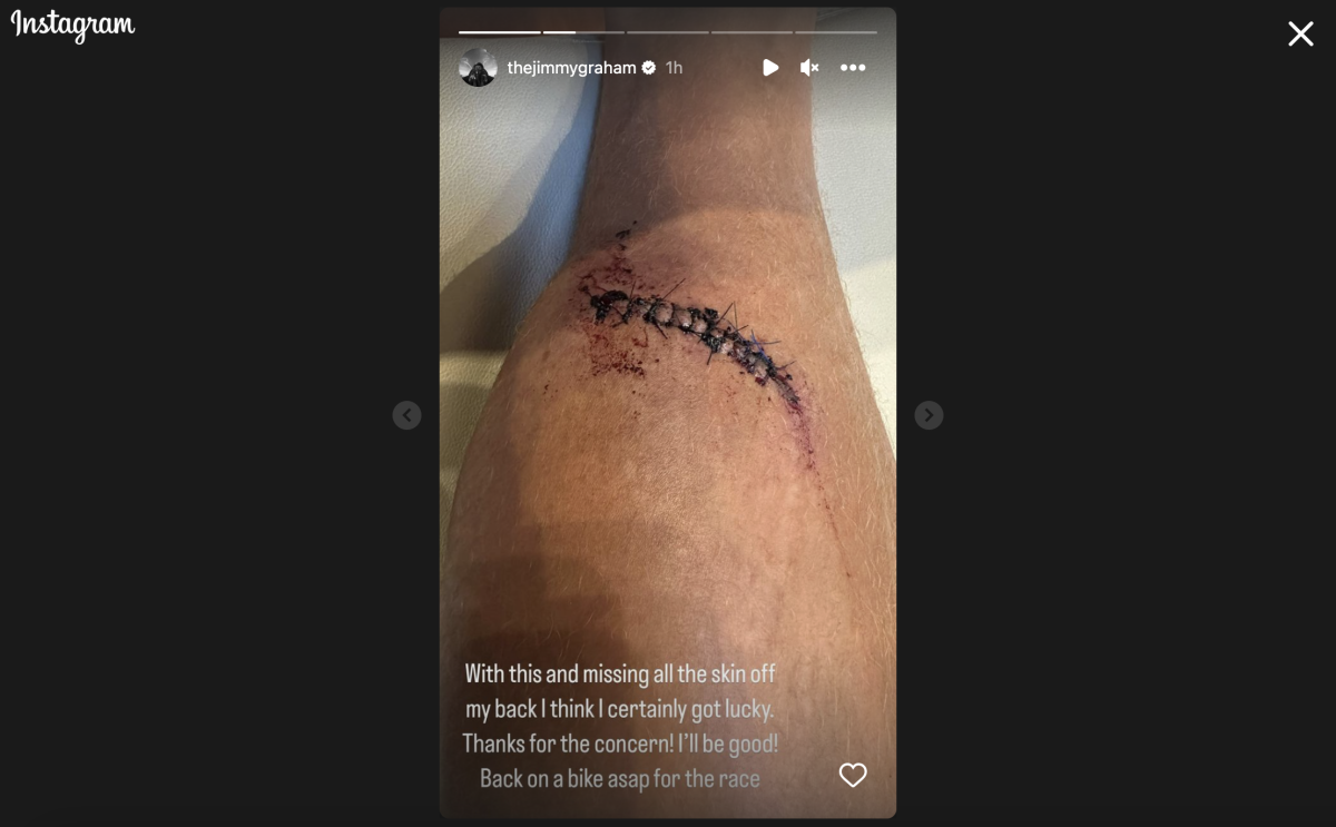 Jimmy Graham Shows Gnarly Leg Wound Suffered In Bike Crash